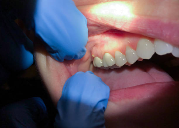 Best Pediatric Emergency Dentist in Barnum Island, NY